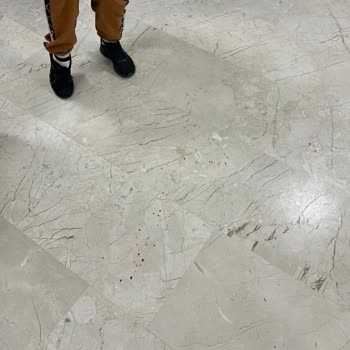 Medipol Esenler Hastanesi Laboratuvarındaki Sorumsuzluk