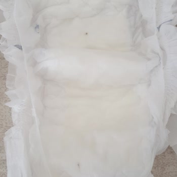 Babyone Bebek Bezini İç Kısmından Siyah Bir Şeyler Çıktı