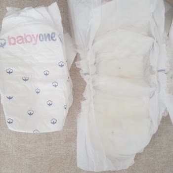 Babyone Bebek Bezini İç Kısmından Siyah Bir Şeyler Çıktı