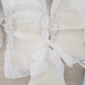 Babyone Bebek Bezini İç Kısmından Siyah Bir Şeyler Çıktı