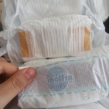 Molfix Bebek Bezi Kalitesizliği