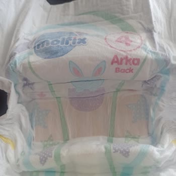 Molfix Bebek Bezi Kalitesizliği