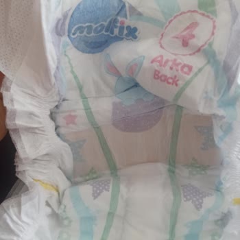 Molfix Bebek Bezi Kalitesizliği