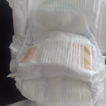 Molfix Bebek Bezi Kalitesizliği