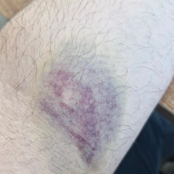 Vega Hospital Sizce Doğru Bir İşlem Mi?