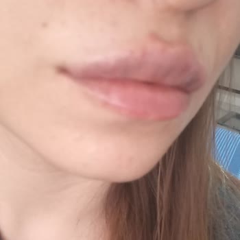 Uzm. Dr. Yahya Yiğit Pişmanlığı