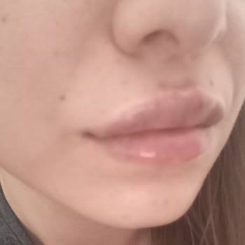 Uzm. Dr. Yahya Yiğit Pişmanlığı