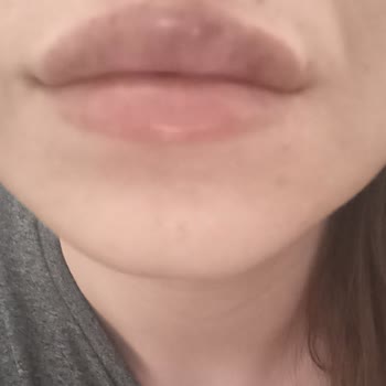 Uzm. Dr. Yahya Yiğit Pişmanlığı