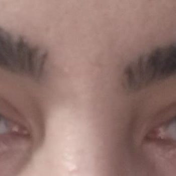 Uzm. Dr. Yahya Yiğit Pişmanlığı