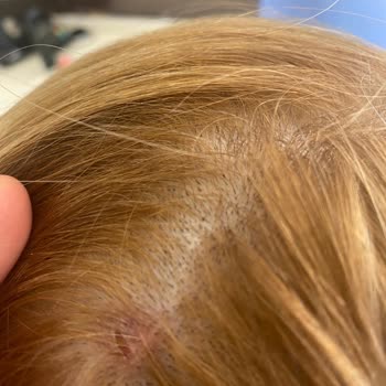 Palette Kafamda Yara Çıktı