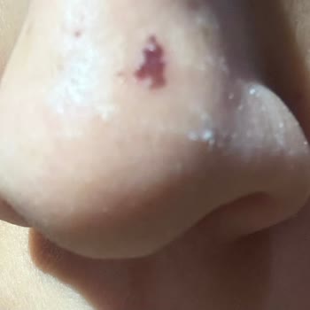 Suit Güzellik Merkezleri Çukurambar, Kötü Bir İşletme Deneyimi Yaşadım!