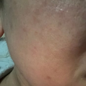 Cilt Sorunlarına Neden Olan Bioderma Ürünleri