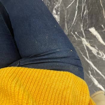 Mudo Kazak Tüy Problemi