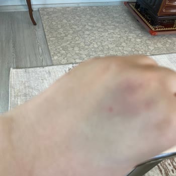 Özel Olbamed Hastanesi Silifke Olbamed Hastanesi Acil Servis