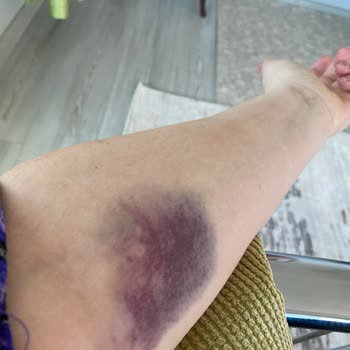 Özel Olbamed Hastanesi Silifke Olbamed Hastanesi Acil Servis