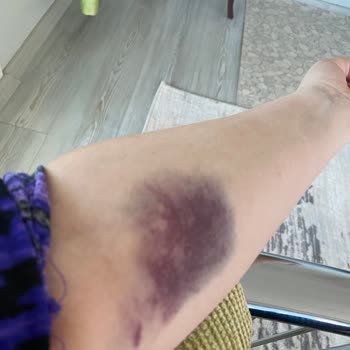 Özel Olbamed Hastanesi Silifke Olbamed Hastanesi Acil Servis