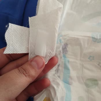 Molfix Yapışkan Yerleri Kopuyor