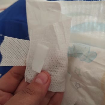 Molfix Yapışkan Yerleri Kopuyor