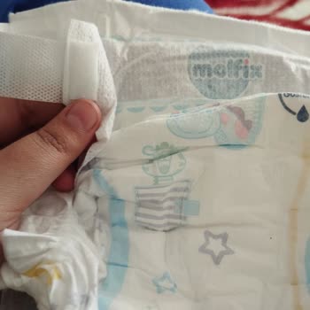 Molfix Yapışkan Yerleri Kopuyor