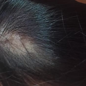 Setri Nur Yüzünden Saçımdan Oldum!