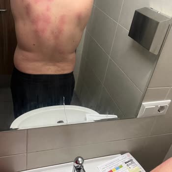 Ankamed Epilasyon ve Güzellik Hizmetleri Ankamed Güzellik Salonu (yandım)