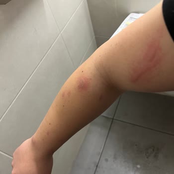 Ankamed Epilasyon ve Güzellik Hizmetleri Ankamed Güzellik Salonu (yandım)