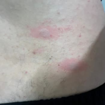 Ankamed Epilasyon ve Güzellik Hizmetleri Ankamed Güzellik Salonu (yandım)