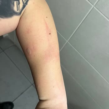 Ankamed Epilasyon ve Güzellik Hizmetleri Ankamed Güzellik Salonu (yandım)