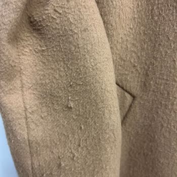 Network Kaban Aşırı Tüylenme Sorunu