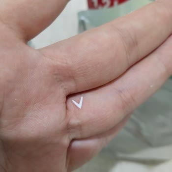 Sma Optipro 2 Mama İçinde Kağıt Parçası Çıktı
