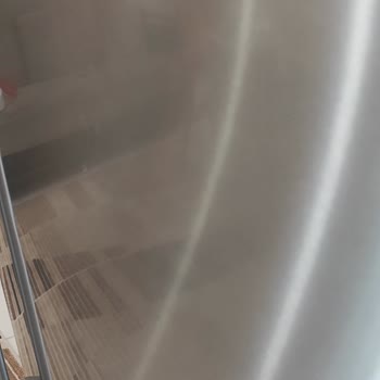 Siemens Servisinin İlgisizliği Ve Sorumsuzluğu