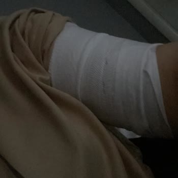 Citroen Hava Yastığı Yanık