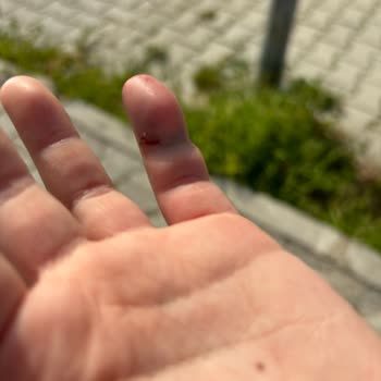 Ege Üniversitesi Hastanesi Çocuk Acil Şikayeti