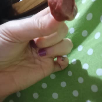 Banvit Sosisin İçerisinden Hayvan Tüyü Çıkıyor