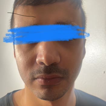 Op. Dr. Furkan Şengöz Ameliyat Hüsranla Sonuçlandı