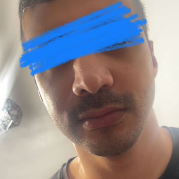 Op. Dr. Furkan Şengöz Ameliyat Hüsranla Sonuçlandı