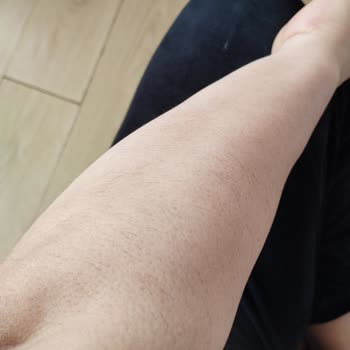 Çiğdem Gülbeyaz Beauty Lazer Hüsrenı!