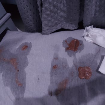 Möller's Omega 3 Çocuk Balık Yağı Yan Etkileri