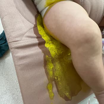 Prima Care Bez Sızdırıyor