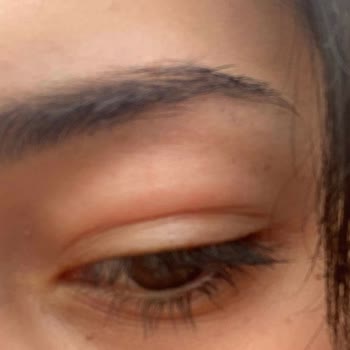 Labella Lens Markası Yüzünden Gözüm Bakteri Kaptı