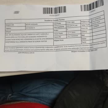 Skechers 2 Yıl Garanti Veriyor Ama Yalanmış