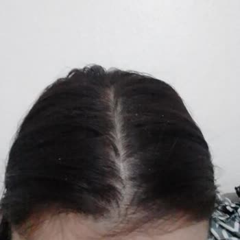 Eve Ürünü Kuru Şampuan Saçıma Kepek Yaptı