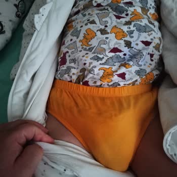 Molfix Bezleri Çok Kötü