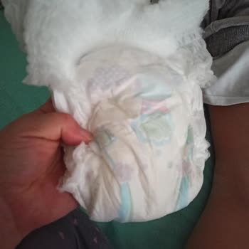 Molfix Bezleri Çok Kötü