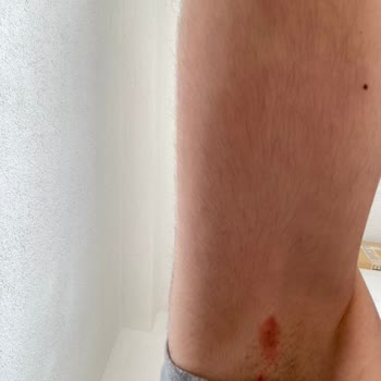 Fa Deodorant Fa Sport Deodorant Yanığı