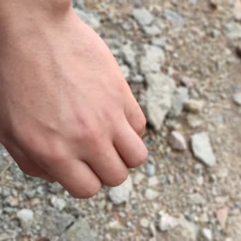 Derimer Dermatoloji Ciltte Oluşan Kızarıklık