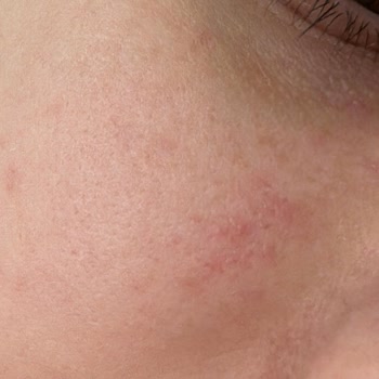 İnside Out Markasının İçeriklerinin Kötü Ve Kalitesiz Olması