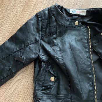 H&M Bebek Deri Cekette Deri Döküntüsü