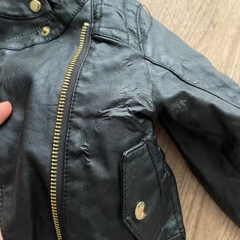 H&M Bebek Deri Cekette Deri Döküntüsü