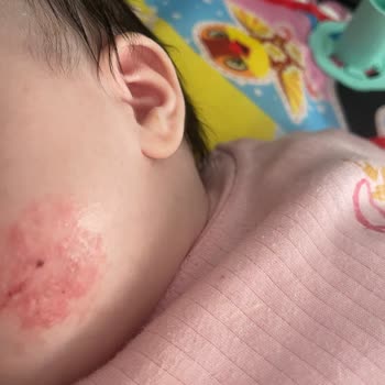 Sma Mama Bebeğimin Yüzünü Kızarttı